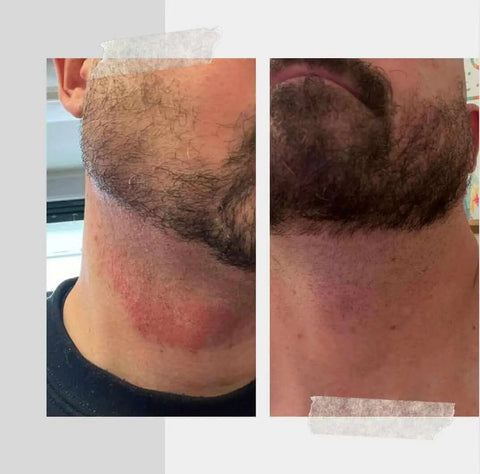 Hydrating Face Butter Without Essential Oils Born to be Free  Face cream