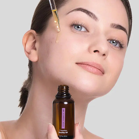 A woman applies Open Formula Rosehip Oil to her cheek with a dropper, holding a brown bottle against a light gray background, highlighting her natural skincare routine.